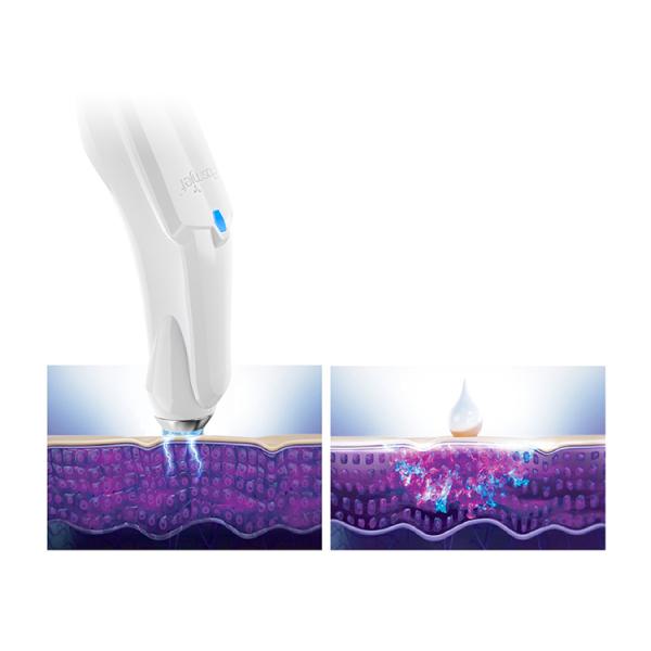 Máquina médica para el cuidado facial Helio Plasma Jet Dispositivo para el cuidado de la piel Para salón de belleza