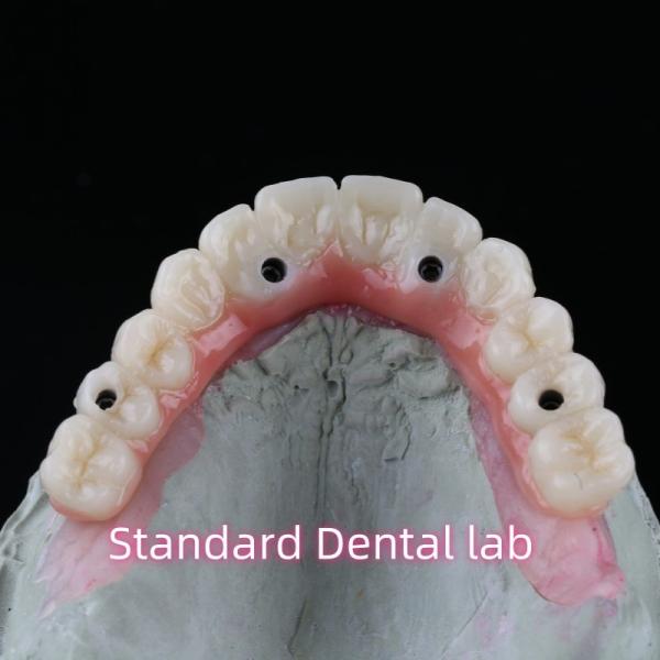 Puente de implantes dentales de porcelana de zirconia alta estética profesional con chicle rosa