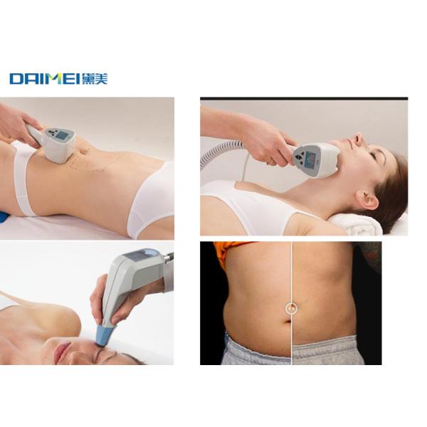 High Power BTL HIFU Skin Tightening Machine , Cavitation RF Slimming Machine