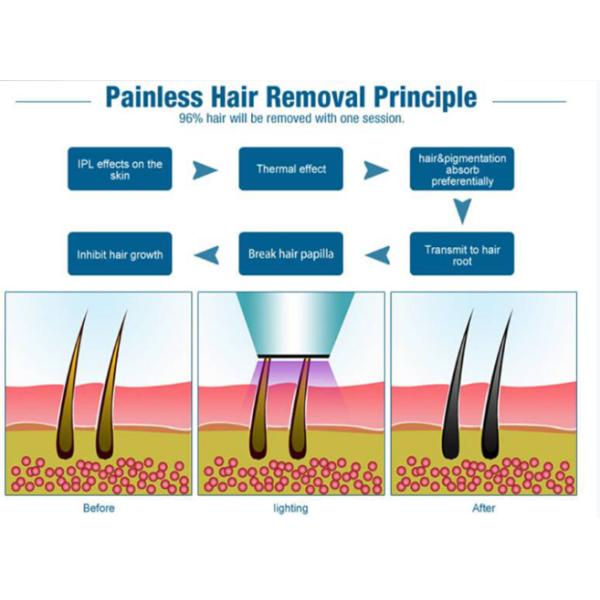 Multifunctional Laser Hair Removal Device , Ipl Machine For Skin Rejuvenation -5 - 0℃ Skin Cooling