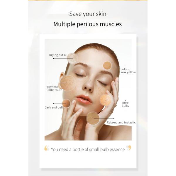 Большая часть освещает веснушку обработки сыворотки корректора темного пятна забеливая сыворотку сути лицевую