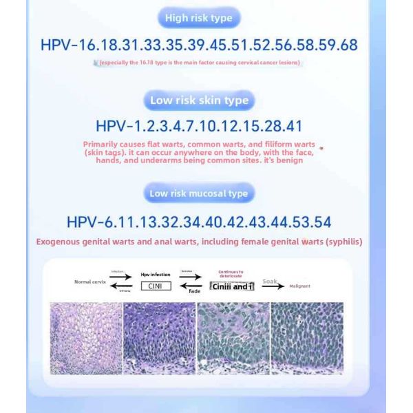 Anti-HPV bio-protein gel vaginal care: soothing, safe, and non-irritating.
