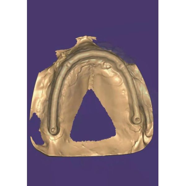 Customized 3D Model Zirconia Crown Offering Long-lasting Durability Designed To Meet The Needs Of Dental Professionals And Laboratories