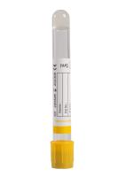 Calidad de muestra superior tubo de análisis de sangre al vacío vidrio 5 ml tiempo de preparación de la muestra reducido personalizado