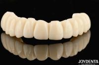 Customizable Ti-Base Zirconia Hybrid Bridge With Excellent Durability And Good Biocompatibility