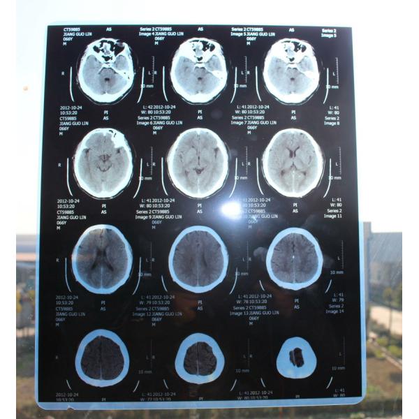 Blue PET Inkjet Medical X Ray Film For Epson Printer