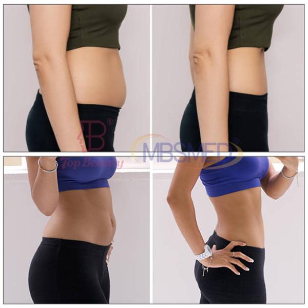 448khz Deep Beauty Tecar Therapy Machine Радиочастотное удаление целлюлита