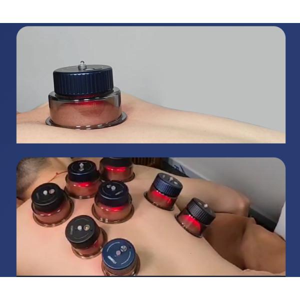 Rated Power Cupping Device 7w Cup 1w Fitdash Gua Sha Cupping Stimulate Massage Equipment