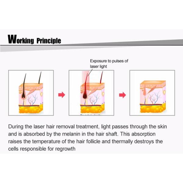Машина удаления волос депиляции 808nm диода оборудования красоты лазера подмолаживания кожи
