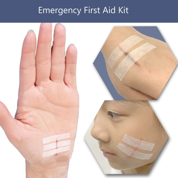 Hospital Surgical Sterile Wound Closure Strips Athletic Adhesive Skin Closure Strip