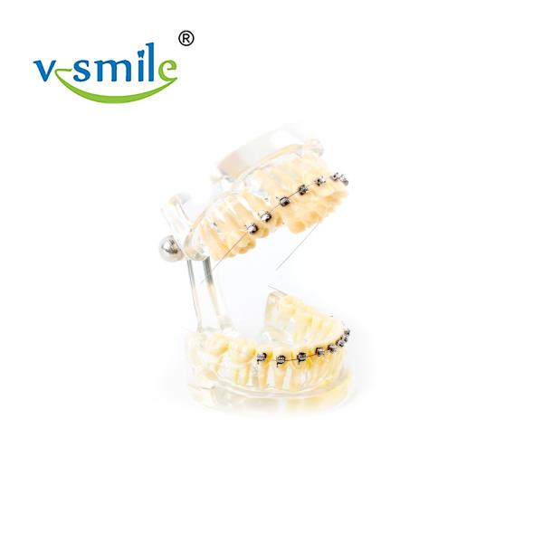 Oral Orthodontics Stainless Steel Self Ligating Brackets 0.022'' 0.018''