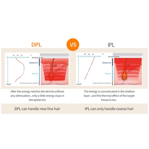 Photorejuvenation угорь удаления волос IPL HR elight DPL машина красоты постоянного лицевая многофункциональная