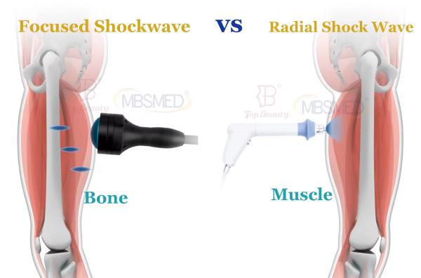 Focused shockwave  Musculoskeletal Rehabilitation Focused Shockwave Therapy Osteopathy Equipment