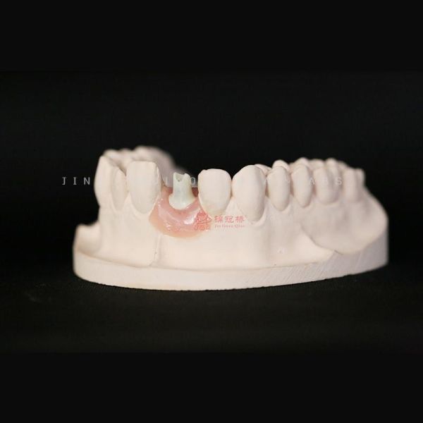 Dental Zirconia Custom Abutment Lab Precise Esthetical As Strong As Titanium