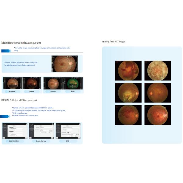 13 мм WD Non Mydriatic Fundus Camera 50° FOV Автоматический/ручный фокус