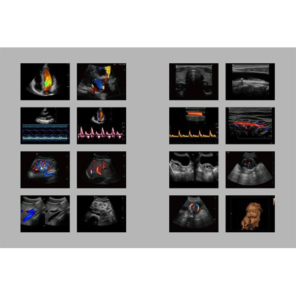 Sonoscape S9 Pregnant Baby Medical Diagnosis 4D Color Doppler Sonography Machine Portable Ultrasound