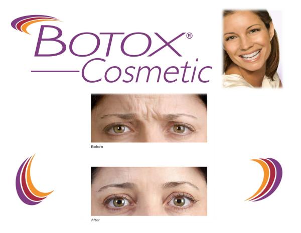 100 Unit Allergan  Injection Anti Wrinkles For Face