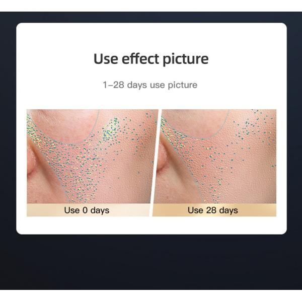 Ручная инфракрасная красная терапия уход за лицом отбеливание кожи светодиодное устройство