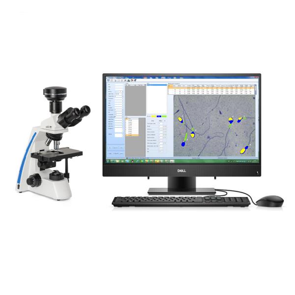 Semi Automatic Sperm Analysis System Computer Controlled Sperm Analyzer