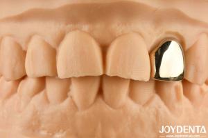 Gold 60K Metallic Oral Crown Abrasion Resistant Dental Crown Wax Casting
