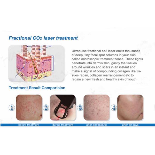 40W Stationary Fractional CO2 Laser Machine Cutting Probes TUV