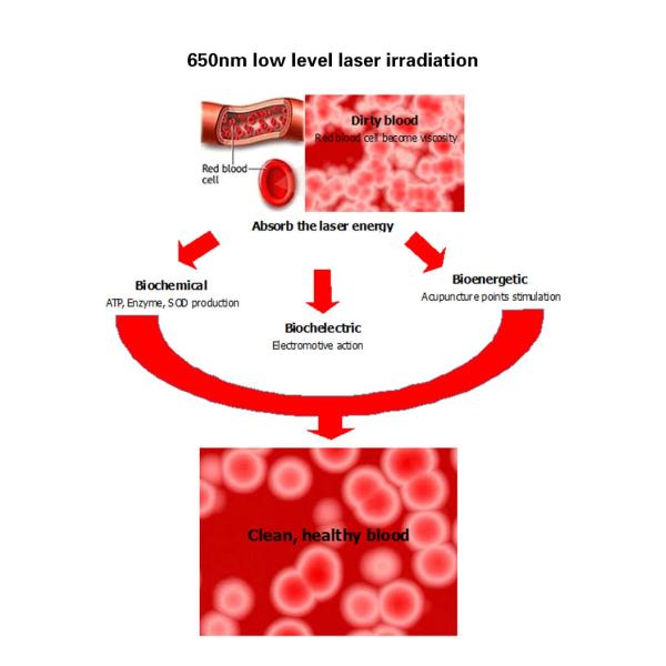 Physical Lllt Laser Wrist Watch