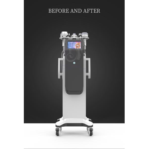 Radio Frequency S Shape 80k Ultrasonic Cavitation Vacuum Massage Bipolar Rf Fast Slimming Machine