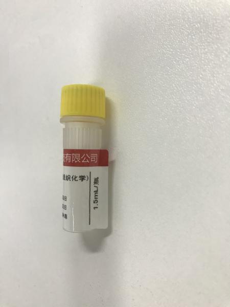 KISSH Primary Antibody Products Ki-67 Immunoassay Antibody Test IHC 1.5mL 3.0mL