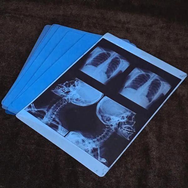Inkjet Medical X-ray Film Compatible With Canon HP And Epson Inkjet Film Printer