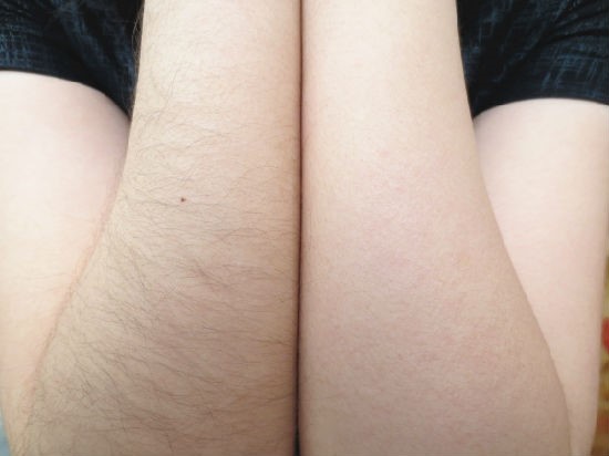 4 в 1 машине лазера Nd Yag, машина удаления волос лазера диода Elight IPL