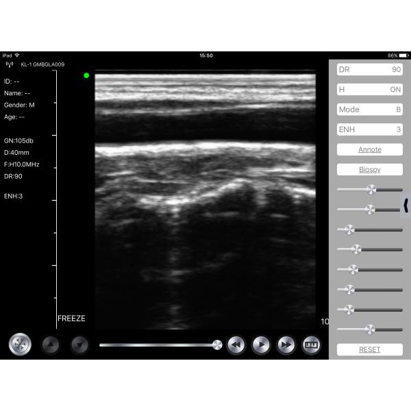 GH Medical Hospital Equipments G10LN 128E Linear Wireless Vascular Probe Ultrasound 10Mhz