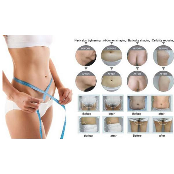 Mini Powerful Cavitation + Vacuum + Fractional Rf Body Slimming Equipment