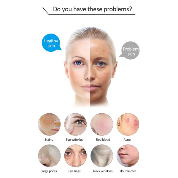 машина лазера удаления волос диода IPL 480nm 640nm медицинская