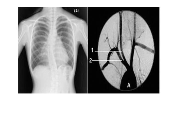 High Sharpness Xray Paper Films , Agfa Dt2b Fuji Medical Thermal Films