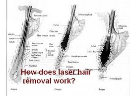 Laser hair removal 2018 hot sale portable 808nm diode laser hair removal machine