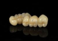Couronne en zirconium solide résistant aux taches combinant une excellente biocompatibilité
