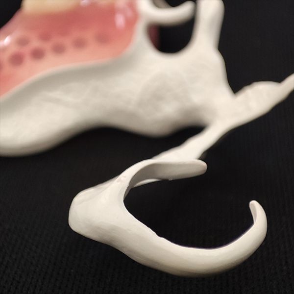 Peek Material Removable Dentures Customized 3D Laser Printing for Natural Fit