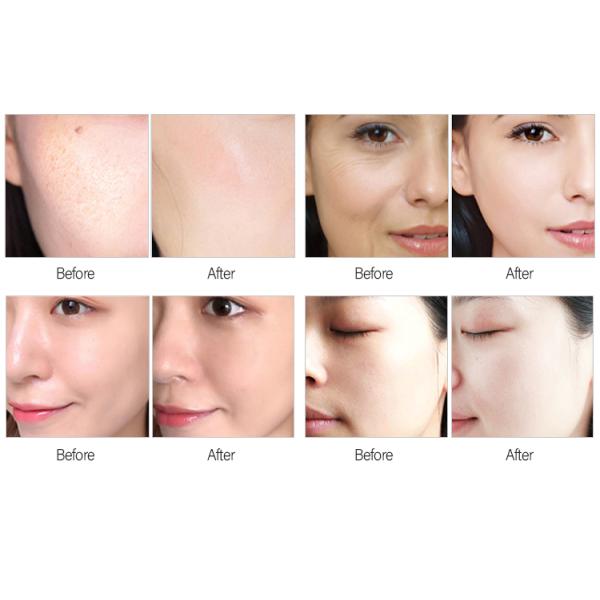 3 in 1 Bubble Oxygen Hydra Dermabrasion Machine CO2 Jet Peel Facial Care Machine