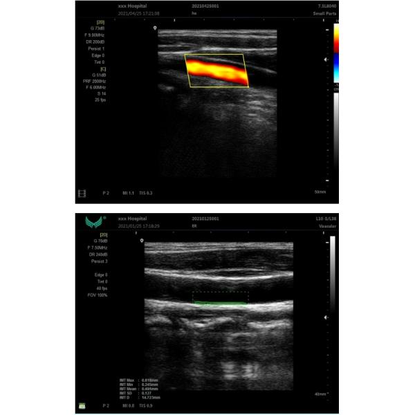 Перезаряжаемые человеческая машина ультразвука для клинического порта VGA HDMI больницы