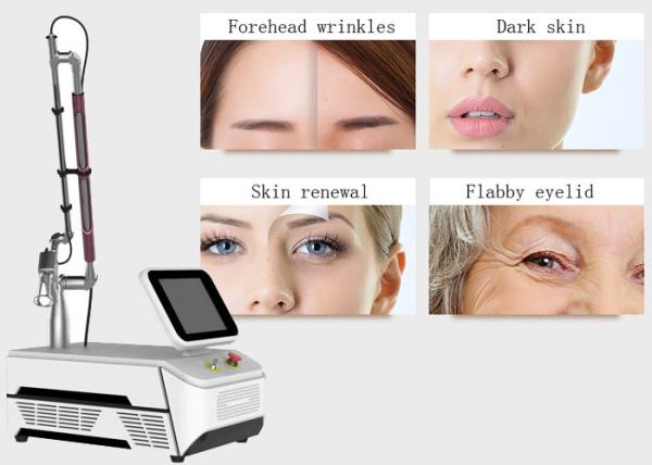Skin Resurfacing Fractional Co2 Laser Equipment 40W Power 2 Years Warranty