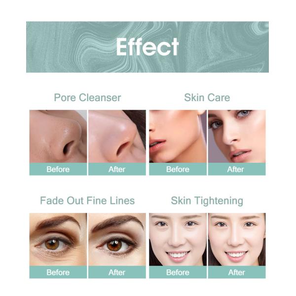 Глубокая очищая машина 10 красоты гидры в 1 заботе кожи Microdermabrasion