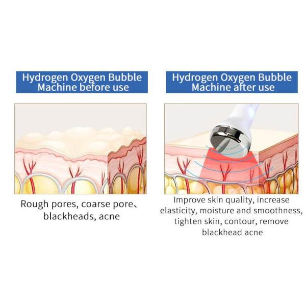 Professional Universal Ultrasonic Water Hydra Facial Machines With 6 Handles