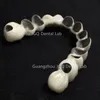 China Dental Artificial Teeth Pfm Dental Metal Ceramic Crown Bridge Customized