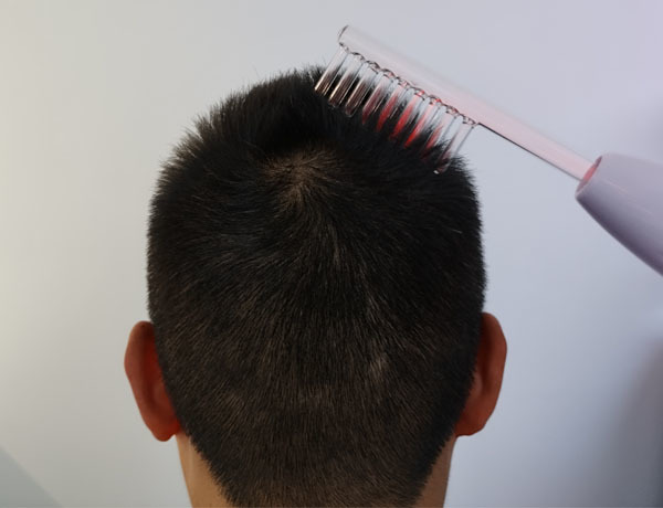 Máquina eléctrica de tratamiento capilar 110 - 240V para el crecimiento del cabello