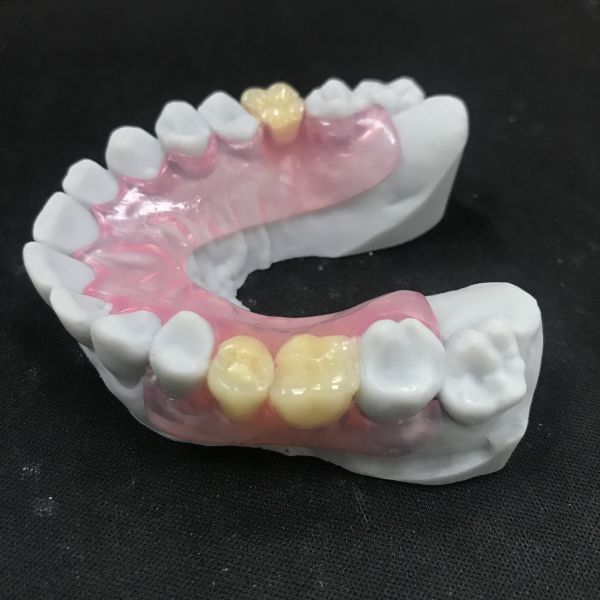 Removable Flexible Denture Valplast Flexible Partial Dentures Prothesis China Dental Lab