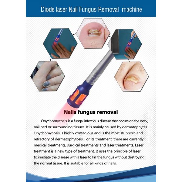Spider Vein Vascular Removal Machine Diode Laser Remover Nails Fungus Physiotherapy