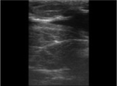 Escáner digital de ultrasonido veterinario