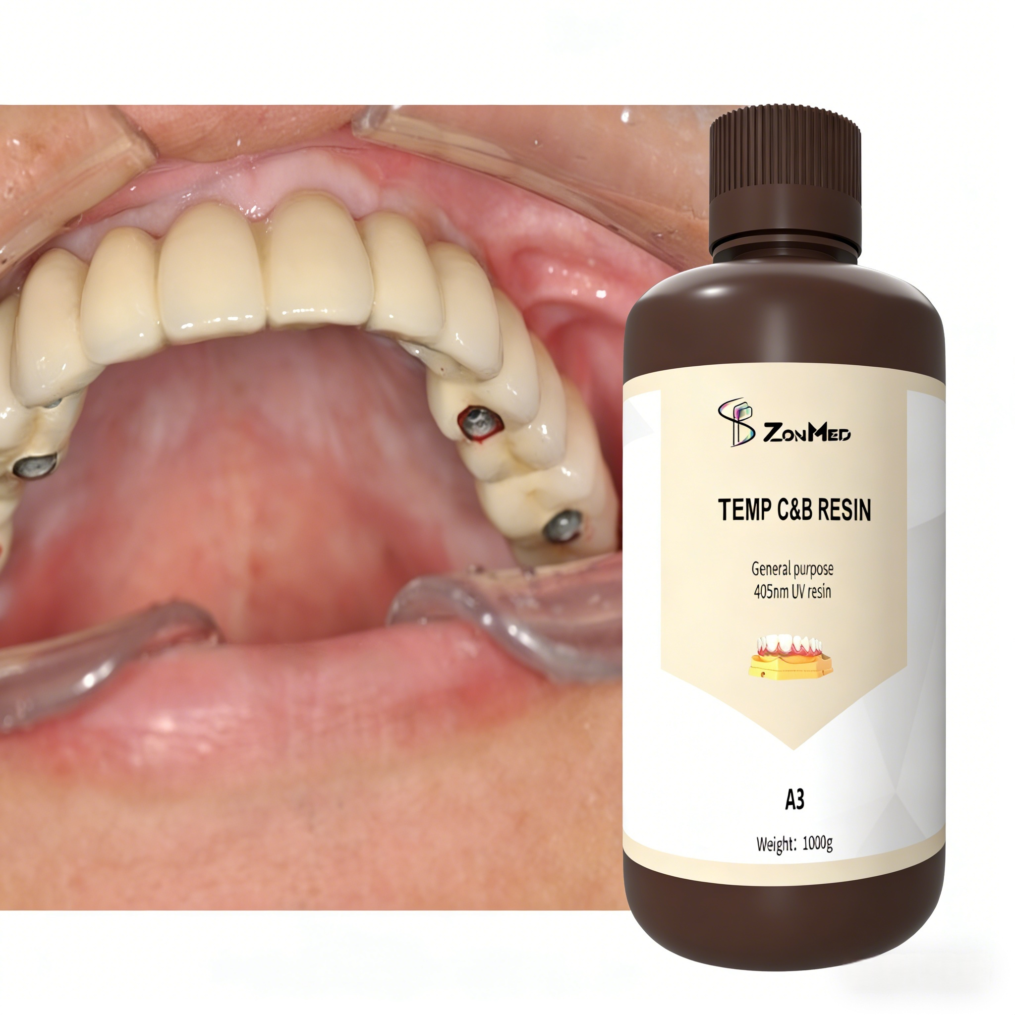 Self cured 3D printing temporary crown resin suitable for regular DLP printer and LCD printer offering polymerization method