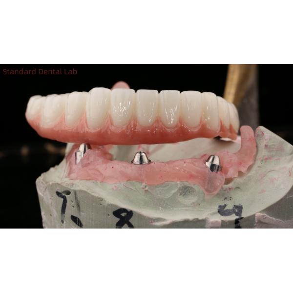 Высококачественная зубная цирконовая корона и All On Four Six Implant Full Arch / Китайская стоматологическая лаборатория