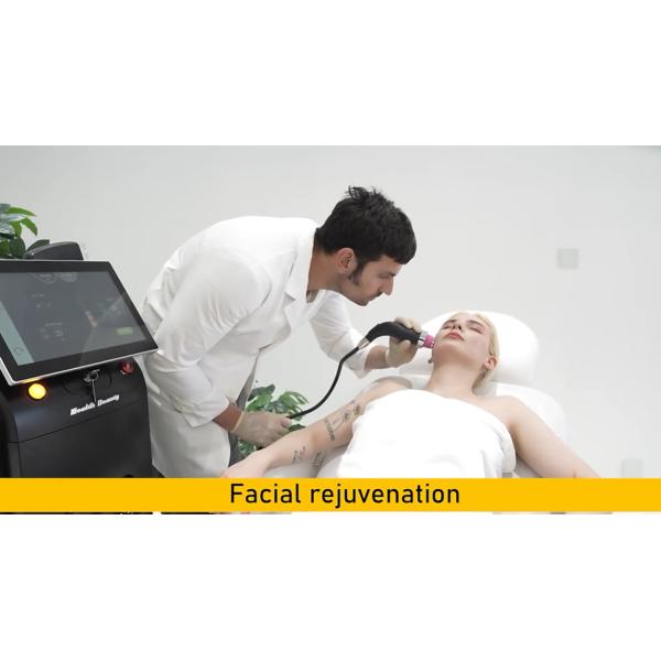 Épilation laser à diode portative 808nm Picosecond Machine d'épilation de tatouage